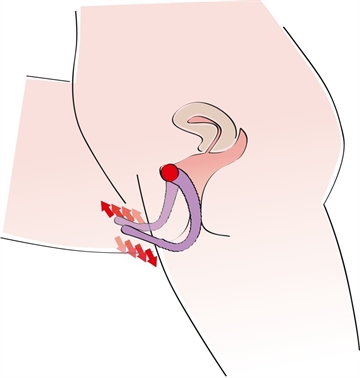 Hotgirl.dk Intimate G-spot skamlæbespreder illustration